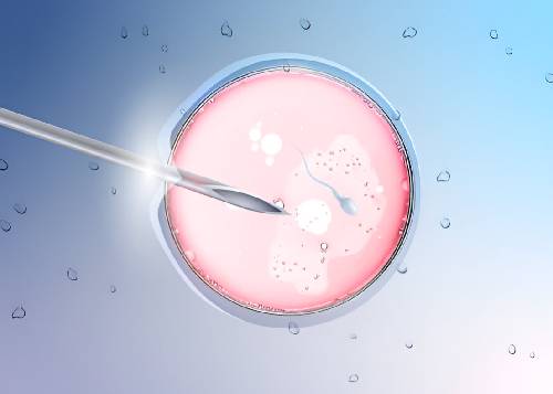 Gynaecologist in Charni Road