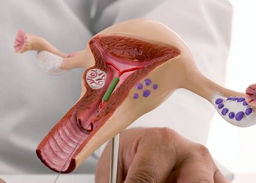 Gynaecologist in Charni Road