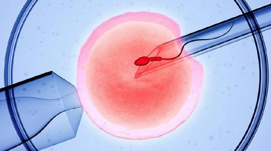 IVF treatment in Girgaon, Charni Road