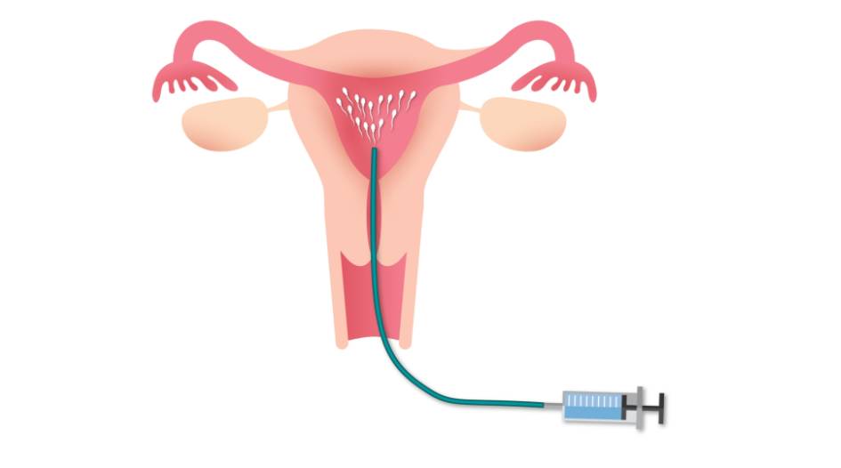 IUI Specialist in Girgaon and Charni Road