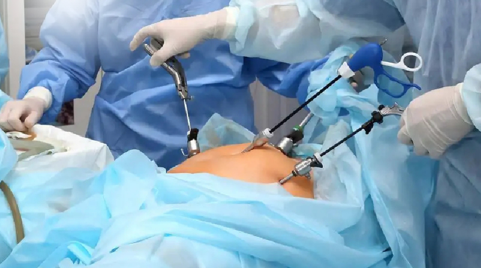 Laparoscopic Surgery Girgaon Charni Road